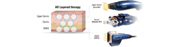 Ultracel Q+ - Image 3